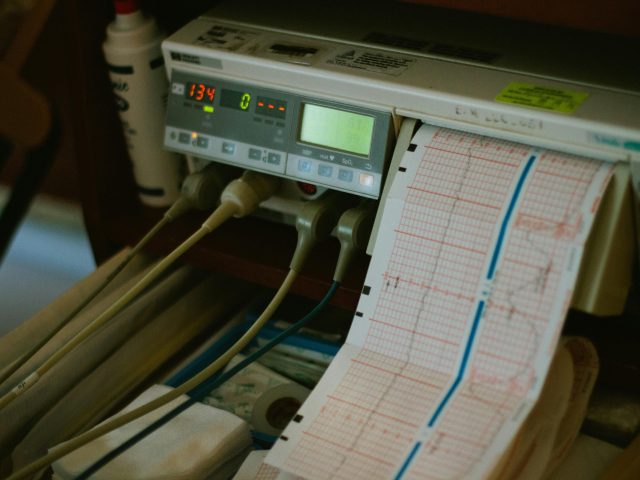 Cele mai frecvente simptome ale hipertensiunii arteriale și cum să le monitorizezi