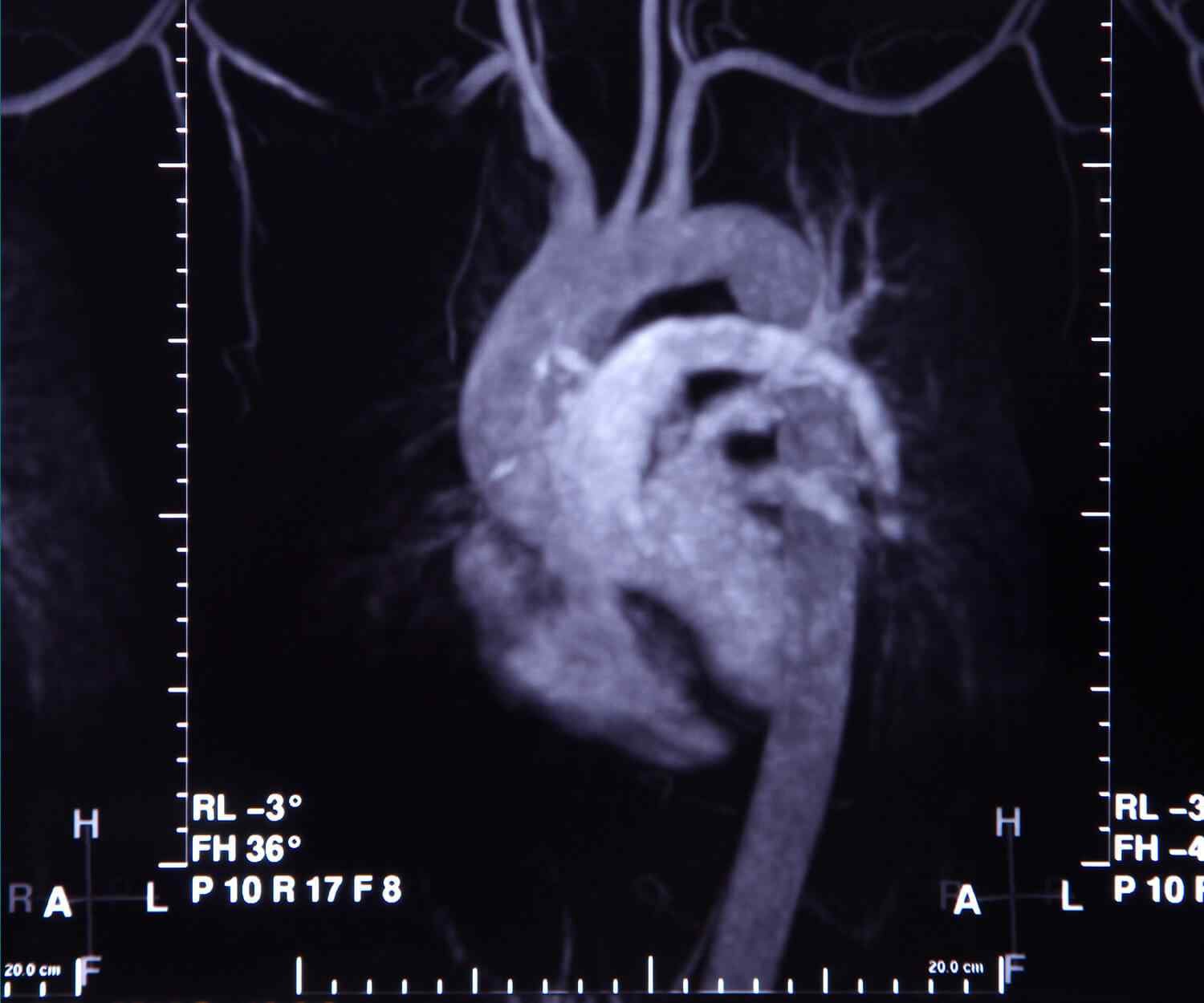 https://dev.homemedica.ro/wp-content/uploads/2021/09/card_image_11.jpg